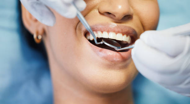 Best Weekend Emergency Dentist in Berry Creek, CA